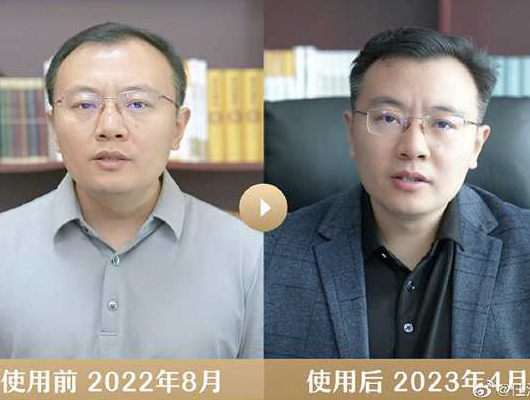 挺秃然的！“网红经济学家”任泽平带货生发液